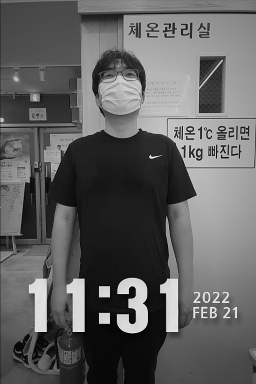 김택환 비포 이미지