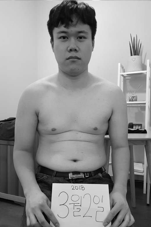 송성호 비포 이미지
